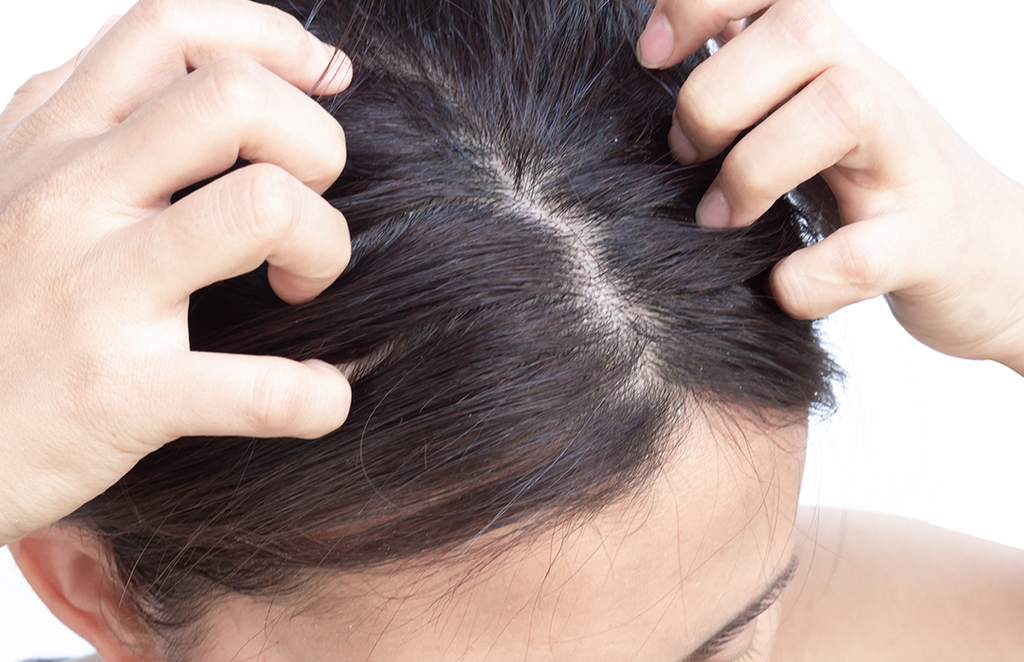 XI HAIR BLOG - How to fix your dry, itchy scalp